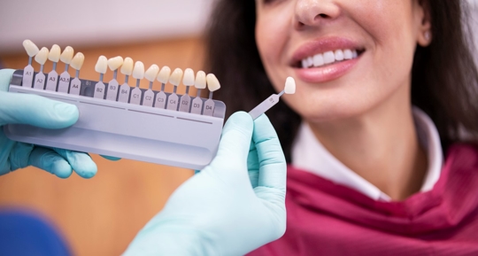 Dentist matching the right white tone for a dental crown using a color swatch palette.